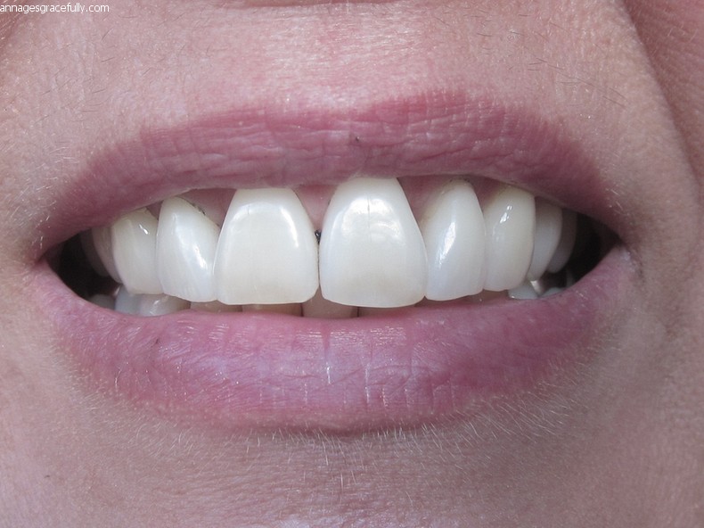 Bloomr Coconut Charcoal